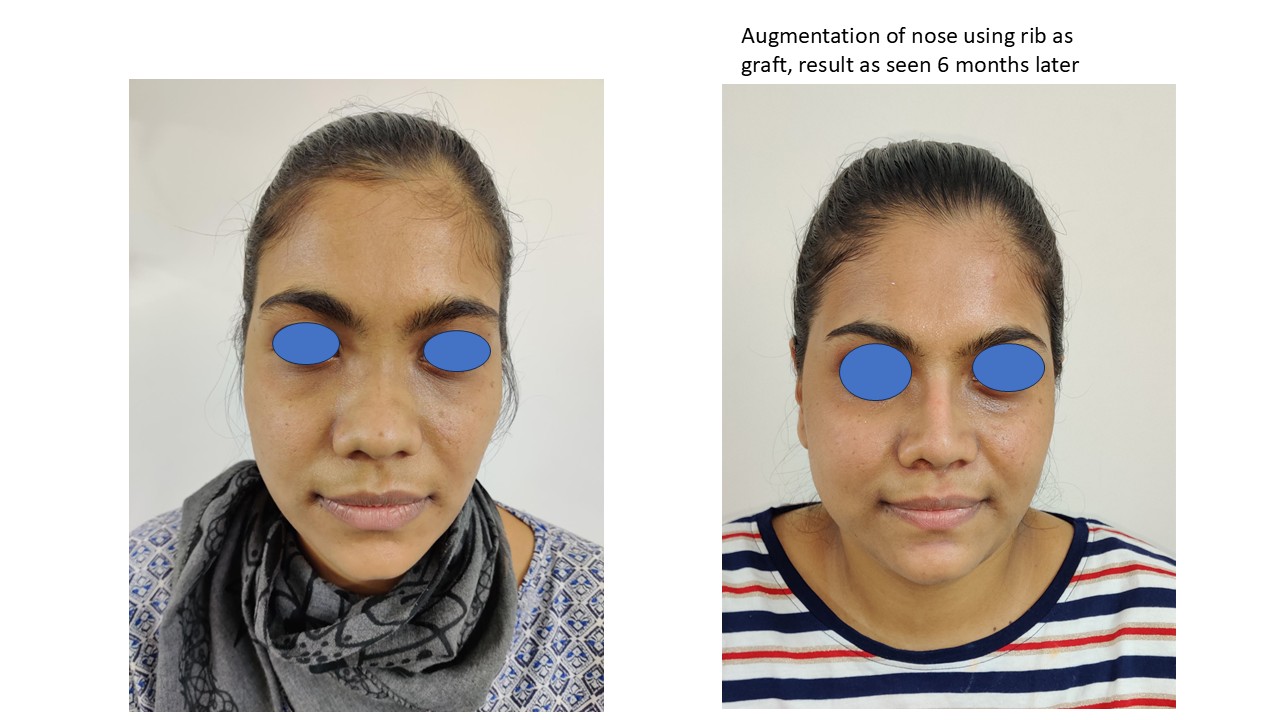 Suvarna Talk Photo 10